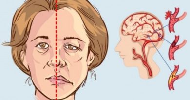 الجلطة الدماغية وطريقة التعافي مابعد الجلطة الدماغية الجلطة الدماغية وطريقة التعافي مابعد الجلطة الدماغية